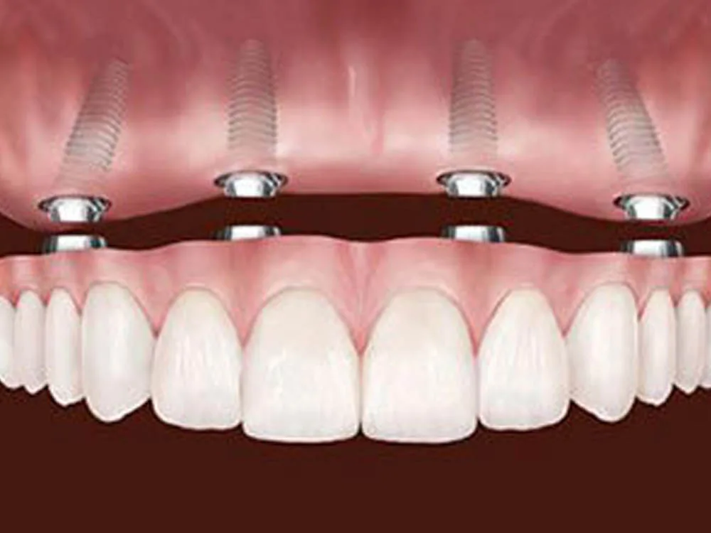 BonisDental